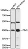 Western blot analysis of extracts of various cell lines, using PIM1 antibody (15-430) at 1:3000 dilution.<br/>Secondary antibody: HRP Goat Anti-Rabbit IgG (H+L) at 1:10000 dilution.<br/>Lysates/proteins: 25ug per lane.<br/>Blocking buffer: 3% nonfat dry milk in TBST.<br/>Detection: ECL Basic Kit.<br/>Exposure time: 90s.