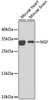 Western blot analysis of extracts of various cell lines, using NGF antibody (15-433) at 1:1000 dilution.<br/>Secondary antibody: HRP Goat Anti-Rabbit IgG (H+L) at 1:10000 dilution.<br/>Lysates/proteins: 25ug per lane.<br/>Blocking buffer: 3% nonfat dry milk in TBST.<br/>Detection: ECL Enhanced Kit.<br/>Exposure time: 60s.