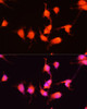 Immunofluorescence analysis of U-251MG cells using NGF antibody (15-433) at dilution of 1:100 (40x lens) . Blue: DAPI for nuclear staining.