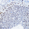 Immunohistochemistry of paraffin-embedded rat ovary using Acetyl-Histone H4-K12 antibody (15-437) at dilution of 1:200 (40x lens) .