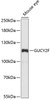 Western blot analysis of extracts of mouse eye, using GUCY2F antibody (15-445) at 1:1000 dilution.<br/>Secondary antibody: HRP Goat Anti-Rabbit IgG (H+L) at 1:10000 dilution.<br/>Lysates/proteins: 25ug per lane.<br/>Blocking buffer: 3% nonfat dry milk in TBST.<br/>Detection: ECL Basic Kit.<br/>Exposure time: 90s.