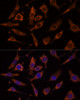 Immunofluorescence analysis of L929 cells using RPL24 Polyclonal Antibody (15-453) at dilution of 1:100 (40x lens) . Blue: DAPI for nuclear staining.