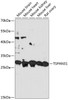 Western blot analysis of extracts of various cell lines, using TSPAN31 antibody (15-454) at 1:3000 dilution.<br/>Secondary antibody: HRP Goat Anti-Rabbit IgG (H+L) at 1:10000 dilution.<br/>Lysates/proteins: 25ug per lane.<br/>Blocking buffer: 3% nonfat dry milk in TBST.<br/>Detection: ECL Basic Kit.<br/>Exposure time: 60s.