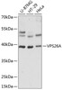 Western blot analysis of extracts of various cell lines, using VPS26A antibody (15-456) at 1:1000 dilution.<br/>Secondary antibody: HRP Goat Anti-Rabbit IgG (H+L) at 1:10000 dilution.<br/>Lysates/proteins: 25ug per lane.<br/>Blocking buffer: 3% nonfat dry milk in TBST.<br/>Detection: ECL Basic Kit.<br/>Exposure time: 5s.