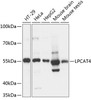 Western blot analysis of extracts of various cell lines, using LPCAT4 antibody (15-481) at 1:3000 dilution.<br/>Secondary antibody: HRP Goat Anti-Rabbit IgG (H+L) at 1:10000 dilution.<br/>Lysates/proteins: 25ug per lane.<br/>Blocking buffer: 3% nonfat dry milk in TBST.<br/>Detection: ECL Basic Kit.<br/>Exposure time: 1s.