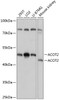 Western blot analysis of extracts of various cell lines, using ACOT2 antibody (15-517) at 1:3000 dilution.<br/>Secondary antibody: HRP Goat Anti-Rabbit IgG (H+L) at 1:10000 dilution.<br/>Lysates/proteins: 25ug per lane.<br/>Blocking buffer: 3% nonfat dry milk in TBST.<br/>Detection: ECL Basic Kit.<br/>Exposure time: 10s.