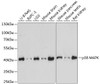 Western blot analysis of extracts of various cell lines, using p38 MAPK antibody (15-523) at 1:1000 dilution.<br/>Secondary antibody: HRP Goat Anti-Rabbit IgG (H+L) at 1:10000 dilution.<br/>Lysates/proteins: 25ug per lane.<br/>Blocking buffer: 3% nonfat dry milk in TBST.<br/>Detection: ECL Basic Kit.<br/>Exposure time: 30s.