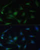 Immunofluorescence analysis of NIH-3T3 cells using p38 MAPK antibody (15-523) at dilution of 1:100. Blue: DAPI for nuclear staining.