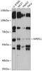 Western blot analysis of extracts of various cell lines, using NPEPL1 antibody (15-531) at 1:3000 dilution.<br/>Secondary antibody: HRP Goat Anti-Rabbit IgG (H+L) at 1:10000 dilution.<br/>Lysates/proteins: 25ug per lane.<br/>Blocking buffer: 3% nonfat dry milk in TBST.<br/>Detection: ECL Basic Kit.<br/>Exposure time: 15s.