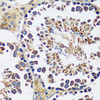 Immunohistochemistry of paraffin-embedded mouse testis using CCDC124 antibody (15-541) at dilution of 1:100 (40x lens) .