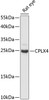 Western blot analysis of extracts of rat eye, using CPLX4 antibody (15-555) at 1:3000 dilution.<br/>Secondary antibody: HRP Goat Anti-Rabbit IgG (H+L) at 1:10000 dilution.<br/>Lysates/proteins: 25ug per lane.<br/>Blocking buffer: 3% nonfat dry milk in TBST.<br/>Detection: ECL Enhanced Kit.<br/>Exposure time: 90s.