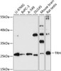 Western blot analysis of extracts of various cell lines, using TRH antibody (15-561) at 1:3000 dilution.<br/>Secondary antibody: HRP Goat Anti-Rabbit IgG (H+L) at 1:10000 dilution.<br/>Lysates/proteins: 25ug per lane.<br/>Blocking buffer: 3% nonfat dry milk in TBST.<br/>Detection: ECL Basic Kit.<br/>Exposure time: 90s.