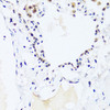 Immunohistochemistry of paraffin-embedded human lung using BRIX1 antibody (15-566) at dilution of 1:100 (40x lens) .