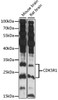 Western blot analysis of extracts of various cell lines, using CDK5R1 antibody (15-572) at 1:3000 dilution.<br/>Secondary antibody: HRP Goat Anti-Rabbit IgG (H+L) at 1:10000 dilution.<br/>Lysates/proteins: 25ug per lane.<br/>Blocking buffer: 3% nonfat dry milk in TBST.<br/>Detection: ECL Basic Kit.<br/>Exposure time: 30s.
