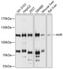 Western blot analysis of extracts of various cell lines, using AHR antibody (15-576) at 1:1000 dilution.<br/>Secondary antibody: HRP Goat Anti-Rabbit IgG (H+L) at 1:10000 dilution.<br/>Lysates/proteins: 25ug per lane.<br/>Blocking buffer: 3% nonfat dry milk in TBST.<br/>Detection: ECL Basic Kit.<br/>Exposure time: 5s.