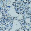 Immunohistochemistry of paraffin-embedded rat lung using AHR antibody (15-576) at dilution of 1:100 (40x lens) .