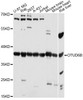 Western blot analysis of extracts of various cell lines, using OTUD6B antibody (15-578) at 1:3000 dilution.<br/>Secondary antibody: HRP Goat Anti-Rabbit IgG (H+L) at 1:10000 dilution.<br/>Lysates/proteins: 25ug per lane.<br/>Blocking buffer: 3% nonfat dry milk in TBST.<br/>Detection: ECL Basic Kit.<br/>Exposure time: 30s.