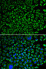 Immunofluorescence analysis of A549 cells using F10 antibody (15-581) . Blue: DAPI for nuclear staining.