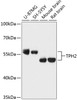 Western blot analysis of extracts of various cell lines, using TPH2 antibody (15-582) at 1:3000 dilution.<br/>Secondary antibody: HRP Goat Anti-Rabbit IgG (H+L) at 1:10000 dilution.<br/>Lysates/proteins: 25ug per lane.<br/>Blocking buffer: 3% nonfat dry milk in TBST.<br/>Detection: ECL Enhanced Kit.<br/>Exposure time: 30s.