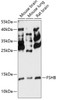 Western blot analysis of extracts of various cell lines, using FSHB antibody (15-589) at 1:3000 dilution.<br/>Secondary antibody: HRP Goat Anti-Rabbit IgG (H+L) at 1:10000 dilution.<br/>Lysates/proteins: 25ug per lane.<br/>Blocking buffer: 3% nonfat dry milk in TBST.<br/>Detection: ECL Basic Kit.<br/>Exposure time: 90s.