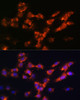 Immunofluorescence analysis of C6 cells using DPP4 antibody (15-597) at dilution of 1:100. Blue: DAPI for nuclear staining.