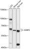 Western blot analysis of extracts of various cell lines, using HABP2 antibody (15-606) at 1:3000 dilution.<br/>Secondary antibody: HRP Goat Anti-Rabbit IgG (H+L) at 1:10000 dilution.<br/>Lysates/proteins: 25ug per lane.<br/>Blocking buffer: 3% nonfat dry milk in TBST.<br/>Detection: ECL Basic Kit.<br/>Exposure time: 30s.