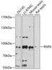 Western blot analysis of extracts of various cell lines, using RNF6 antibody (15-610) at 1:1000 dilution.<br/>Secondary antibody: HRP Goat Anti-Rabbit IgG (H+L) at 1:10000 dilution.<br/>Lysates/proteins: 25ug per lane.<br/>Blocking buffer: 3% nonfat dry milk in TBST.<br/>Detection: ECL Basic Kit.<br/>Exposure time: 90s.