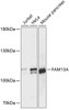 Western blot analysis of extracts of various cell lines, using FAM13A antibody (15-612) at 1:1000 dilution.<br/>Secondary antibody: HRP Goat Anti-Rabbit IgG (H+L) at 1:10000 dilution.<br/>Lysates/proteins: 25ug per lane.<br/>Blocking buffer: 3% nonfat dry milk in TBST.<br/>Detection: ECL Basic Kit.<br/>Exposure time: 5s.