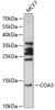 Western blot analysis of extracts of MCF7 cells, using COA3 antibody (15-616) at 1:1000 dilution.<br/>Secondary antibody: HRP Goat Anti-Rabbit IgG (H+L) at 1:10000 dilution.<br/>Lysates/proteins: 25ug per lane.<br/>Blocking buffer: 3% nonfat dry milk in TBST.<br/>Detection: ECL Basic Kit.<br/>Exposure time: 30s.