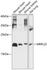 Western blot analysis of extracts of various cell lines, using MRPL22 antibody (15-617) at 1:1000 dilution.<br/>Secondary antibody: HRP Goat Anti-Rabbit IgG (H+L) at 1:10000 dilution.<br/>Lysates/proteins: 25ug per lane.<br/>Blocking buffer: 3% nonfat dry milk in TBST.<br/>Detection: ECL Basic Kit.<br/>Exposure time: 30s.
