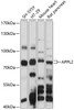 Western blot analysis of extracts of various cell lines, using APPL2 antibody (15-619) at 1:1000 dilution.<br/>Secondary antibody: HRP Goat Anti-Rabbit IgG (H+L) at 1:10000 dilution.<br/>Lysates/proteins: 25ug per lane.<br/>Blocking buffer: 3% nonfat dry milk in TBST.<br/>Detection: ECL Basic Kit.<br/>Exposure time: 90s.