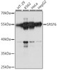 Western blot analysis of extracts of various cell lines, using SRSF6 antibody (15-625) at 1:1000 dilution.<br/>Secondary antibody: HRP Goat Anti-Rabbit IgG (H+L) at 1:10000 dilution.<br/>Lysates/proteins: 25ug per lane.<br/>Blocking buffer: 3% nonfat dry milk in TBST.<br/>Detection: ECL Basic Kit.<br/>Exposure time: 90s.