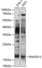 Western blot analysis of extracts of various cell lines, using RNASE12 antibody (15-628) at 1:1000 dilution.<br/>Secondary antibody: HRP Goat Anti-Rabbit IgG (H+L) at 1:10000 dilution.<br/>Lysates/proteins: 25ug per lane.<br/>Blocking buffer: 3% nonfat dry milk in TBST.<br/>Detection: ECL Basic Kit.<br/>Exposure time: 90s.