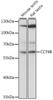 Western blot analysis of extracts of various cell lines, using CCT6B antibody (15-634) at 1:1000 dilution.<br/>Secondary antibody: HRP Goat Anti-Rabbit IgG (H+L) at 1:10000 dilution.<br/>Lysates/proteins: 25ug per lane.<br/>Blocking buffer: 3% nonfat dry milk in TBST.<br/>Detection: ECL Basic Kit.<br/>Exposure time: 15s.