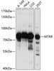 Western blot analysis of extracts of various cell lines, using MTRR antibody (15-635) at 1:1000 dilution.<br/>Secondary antibody: HRP Goat Anti-Rabbit IgG (H+L) at 1:10000 dilution.<br/>Lysates/proteins: 25ug per lane.<br/>Blocking buffer: 3% nonfat dry milk in TBST.<br/>Detection: ECL Basic Kit.<br/>Exposure time: 20s.