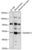 Western blot analysis of extracts of various cell lines, using KIAA0513 antibody (15-648) at 1:1000 dilution.<br/>Secondary antibody: HRP Goat Anti-Rabbit IgG (H+L) at 1:10000 dilution.<br/>Lysates/proteins: 25ug per lane.<br/>Blocking buffer: 3% nonfat dry milk in TBST.<br/>Detection: ECL Basic Kit.<br/>Exposure time: 1s.