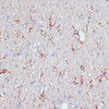 Immunohistochemistry of paraffin-embedded rat brain using GFAP antibody (15-662) at dilution of 1:200 (40x lens) .