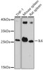 Western blot analysis of extracts of various cell lines, using IL6 antibody (15-666) at 1:1000 dilution.<br/>Secondary antibody: HRP Goat Anti-Rabbit IgG (H+L) at 1:10000 dilution.<br/>Lysates/proteins: 25ug per lane.<br/>Blocking buffer: 3% nonfat dry milk in TBST.<br/>Detection: ECL Basic Kit.<br/>Exposure time: 90s.