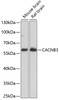 Western blot analysis of extracts of various cell lines, using CACNB3 antibody (15-680) at 1:1000 dilution.<br/>Secondary antibody: HRP Goat Anti-Rabbit IgG (H+L) at 1:10000 dilution.<br/>Lysates/proteins: 25ug per lane.<br/>Blocking buffer: 3% nonfat dry milk in TBST.<br/>Detection: ECL Enhanced Kit.<br/>Exposure time: 90s.