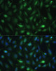 Immunofluorescence analysis of U-2 OS cells using CSNK2B Polyclonal Antibody (15-684) at dilution of 1:100 (40x lens) . Blue: DAPI for nuclear staining.