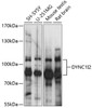 Western blot analysis of extracts of various cell lines, using DYNC1I2 antibody (15-686) at 1:1000 dilution.<br/>Secondary antibody: HRP Goat Anti-Rabbit IgG (H+L) at 1:10000 dilution.<br/>Lysates/proteins: 25ug per lane.<br/>Blocking buffer: 3% nonfat dry milk in TBST.<br/>Detection: ECL Basic Kit.<br/>Exposure time: 1s.