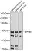 Western blot analysis of extracts of various cell lines, using EPHB6 antibody (15-689) at 1:1000 dilution.<br/>Secondary antibody: HRP Goat Anti-Rabbit IgG (H+L) at 1:10000 dilution.<br/>Lysates/proteins: 25ug per lane.<br/>Blocking buffer: 3% nonfat dry milk in TBST.<br/>Detection: ECL Basic Kit.<br/>Exposure time: 30s.