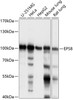 Western blot analysis of extracts of various cell lines, using EPS8 antibody (15-690) at 1:1000 dilution.<br/>Secondary antibody: HRP Goat Anti-Rabbit IgG (H+L) at 1:10000 dilution.<br/>Lysates/proteins: 25ug per lane.<br/>Blocking buffer: 3% nonfat dry milk in TBST.<br/>Detection: ECL Enhanced Kit.<br/>Exposure time: 1s.