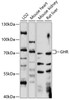 Western blot analysis of extracts of various cell lines, using GHR antibody (15-693) at 1:1000 dilution.<br/>Secondary antibody: HRP Goat Anti-Rabbit IgG (H+L) at 1:10000 dilution.<br/>Lysates/proteins: 25ug per lane.<br/>Blocking buffer: 3% nonfat dry milk in TBST.<br/>Detection: ECL Enhanced Kit.<br/>Exposure time: 30s.