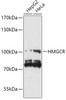 Western blot analysis of extracts of various cell lines, using HMGCR antibody (15-698) at 1:1000 dilution.<br/>Secondary antibody: HRP Goat Anti-Rabbit IgG (H+L) at 1:10000 dilution.<br/>Lysates/proteins: 25ug per lane.<br/>Blocking buffer: 3% nonfat dry milk in TBST.<br/>Detection: ECL Basic Kit.<br/>Exposure time: 30s.