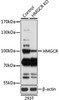 Western blot analysis of extracts from normal (control) and HMGCR knockout (KO) 293T cells, using HMGCR antibody (15-698) at 1:1000 dilution.<br/>Secondary antibody: HRP Goat Anti-Rabbit IgG (H+L) at 1:10000 dilution.<br/>Lysates/proteins: 25ug per lane.<br/>Blocking buffer: 3% nonfat dry milk in TBST.<br/>Detection: ECL Basic Kit.<br/>Exposure time: 3min.