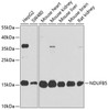 Western blot analysis of extracts of various cell lines, using NDUFB5 antibody (15-707) at 1:1000 dilution.<br/>Secondary antibody: HRP Goat Anti-Rabbit IgG (H+L) at 1:10000 dilution.<br/>Lysates/proteins: 25ug per lane.<br/>Blocking buffer: 3% nonfat dry milk in TBST.<br/>Detection: ECL Basic Kit.<br/>Exposure time: 10s.