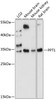 Western blot analysis of extracts of various cell lines, using PPT1 antibody (15-717) at 1:1000 dilution.<br/>Secondary antibody: HRP Goat Anti-Rabbit IgG (H+L) at 1:10000 dilution.<br/>Lysates/proteins: 25ug per lane.<br/>Blocking buffer: 3% nonfat dry milk in TBST.<br/>Detection: ECL Basic Kit.<br/>Exposure time: 30s.