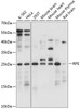 Western blot analysis of extracts of various cell lines, using RPE antibody (15-724) at 1:1000 dilution.<br/>Secondary antibody: HRP Goat Anti-Rabbit IgG (H+L) at 1:10000 dilution.<br/>Lysates/proteins: 25ug per lane.<br/>Blocking buffer: 3% nonfat dry milk in TBST.<br/>Detection: ECL Basic Kit.<br/>Exposure time: 5s.