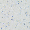 Immunohistochemistry of paraffin-embedded mouse brain using SLC22A5 antibody (15-729) at dilution of 1:100 (40x lens) .